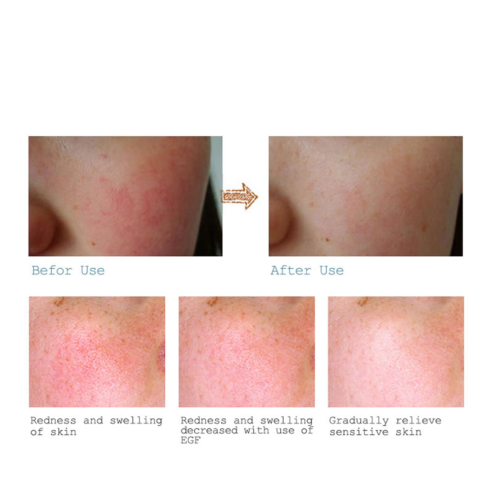 سيروم ماريا لعلاج آثار الحبوب والتجاعيد سيروم ماريا لعلاج آثار الحبوب والتجاعيد